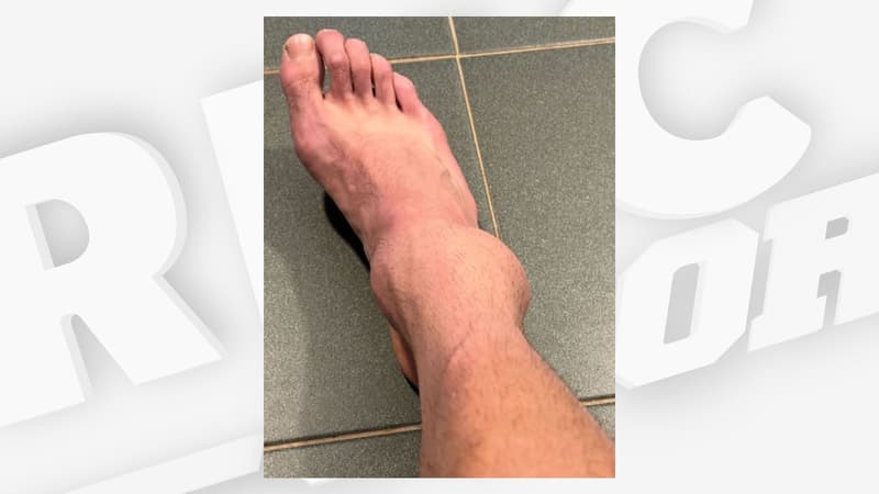 Tennis: les images terribles de la cheville de Cazaux, contraint à l’abandon à un mois de Roland-Garros