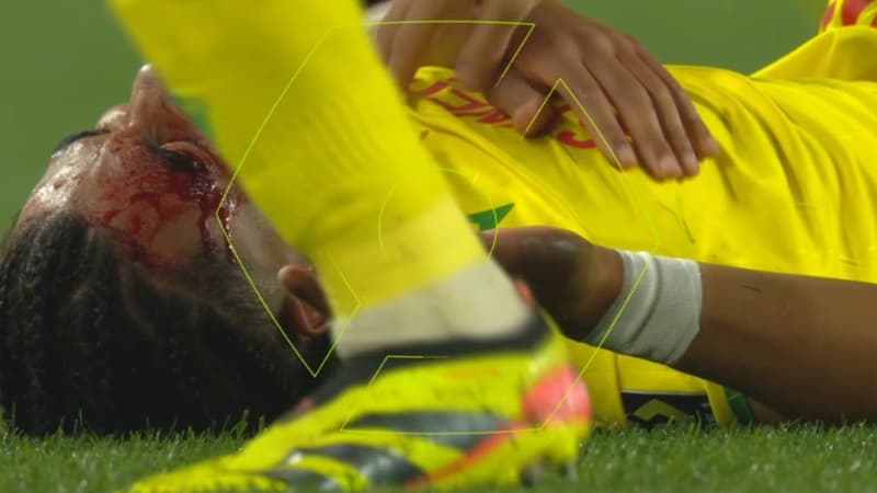 Nantes-OL: “Tu vas la fermer!”, la colère de Kombouaré en plein huis clos pour une faute de Lacazette sur Zézé